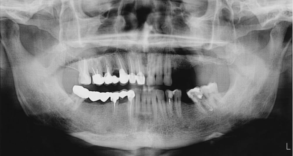 cone-beam-ct-procedure-code-the-best-picture-of-beam