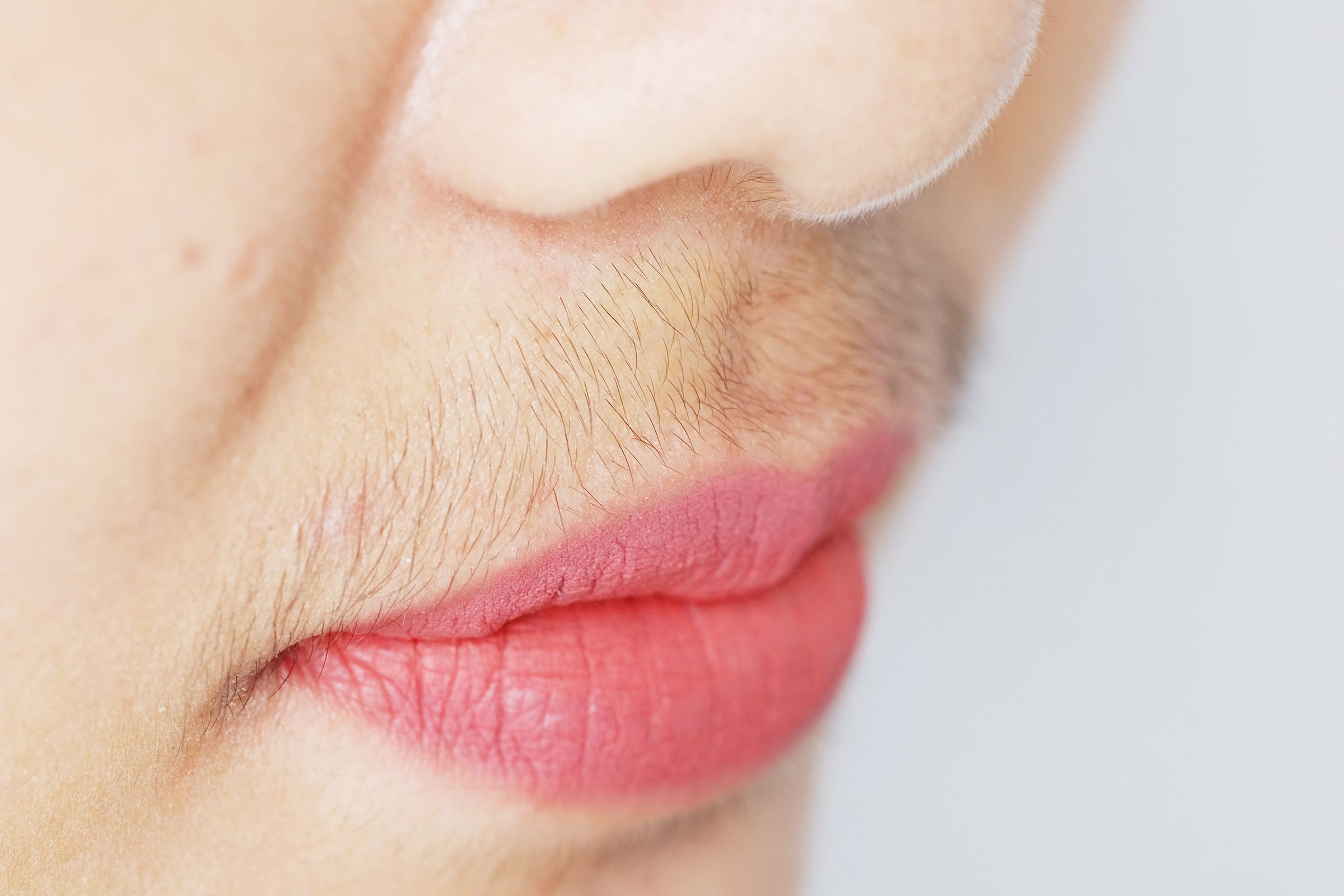 What Hormone Causes Facial Hair Growth In Females