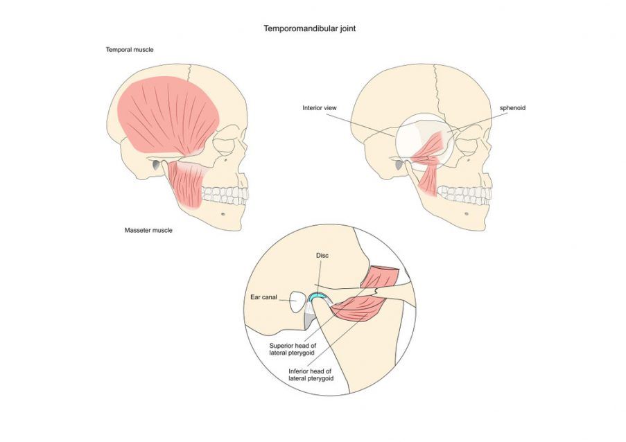 TMJ-Disorders TMJ Disorders