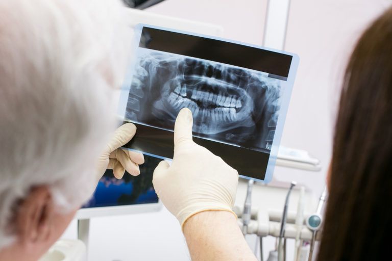 Dental digital x-ray