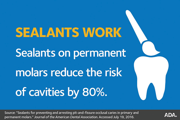 ADA sealants works