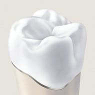 Crown Porcelain Fused to Metal Tooth