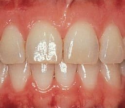 healthy teeth
