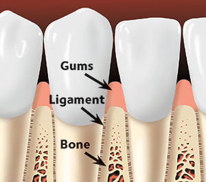 Full Mouth Rehabilitation