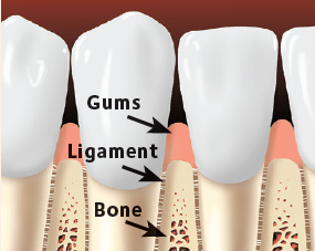 Full Mouth Rehabilitation