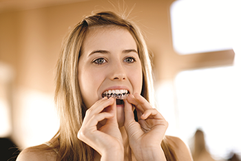Girl putting invisalign in mouth