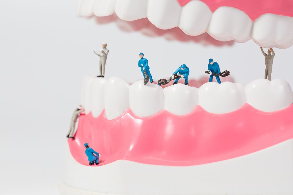 Miniature people or small figure worker cleaning tooth model