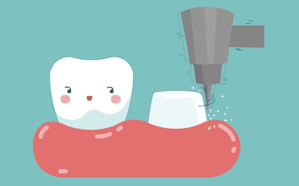 cartoonick Tooth Image
