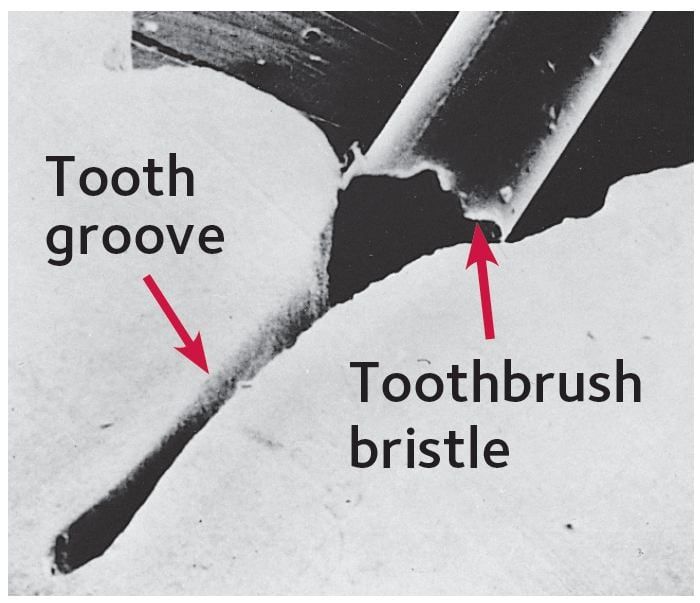 Tooth groove and toothbrush Bristle