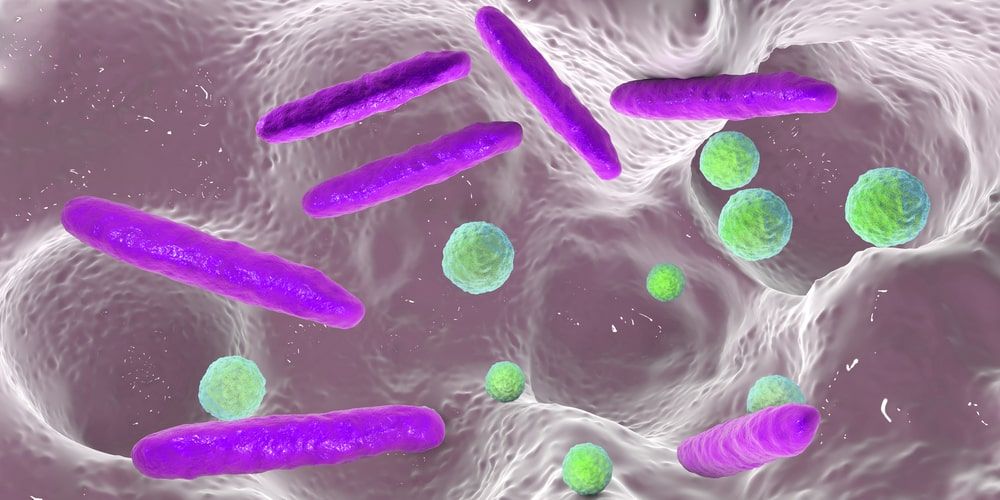 Microscopic image of the bacteria that cause tooth decay