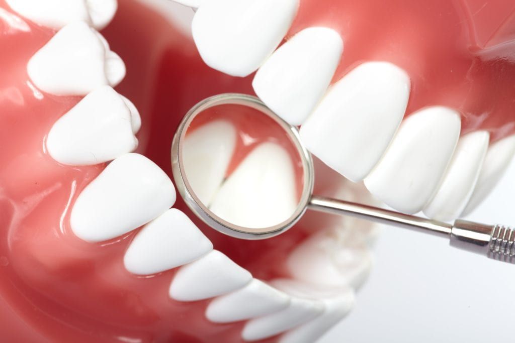 Model of teeth and a dental mirror