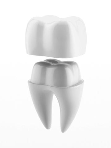 Dental crown model