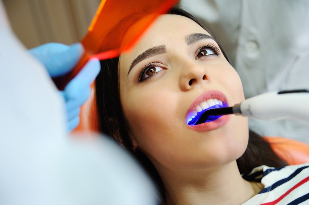 Dental Fillings