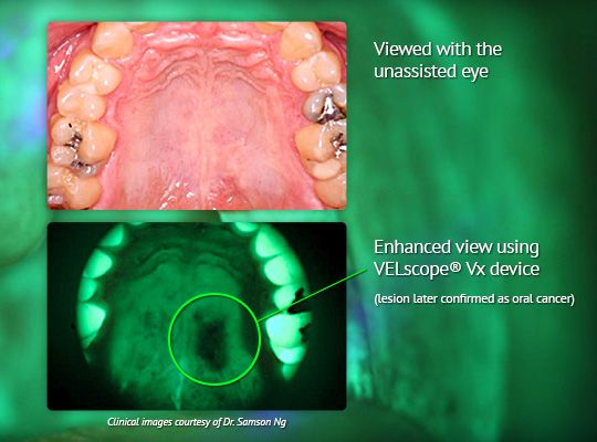 VELscope Image