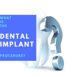 What is the Dental Implant Procedure