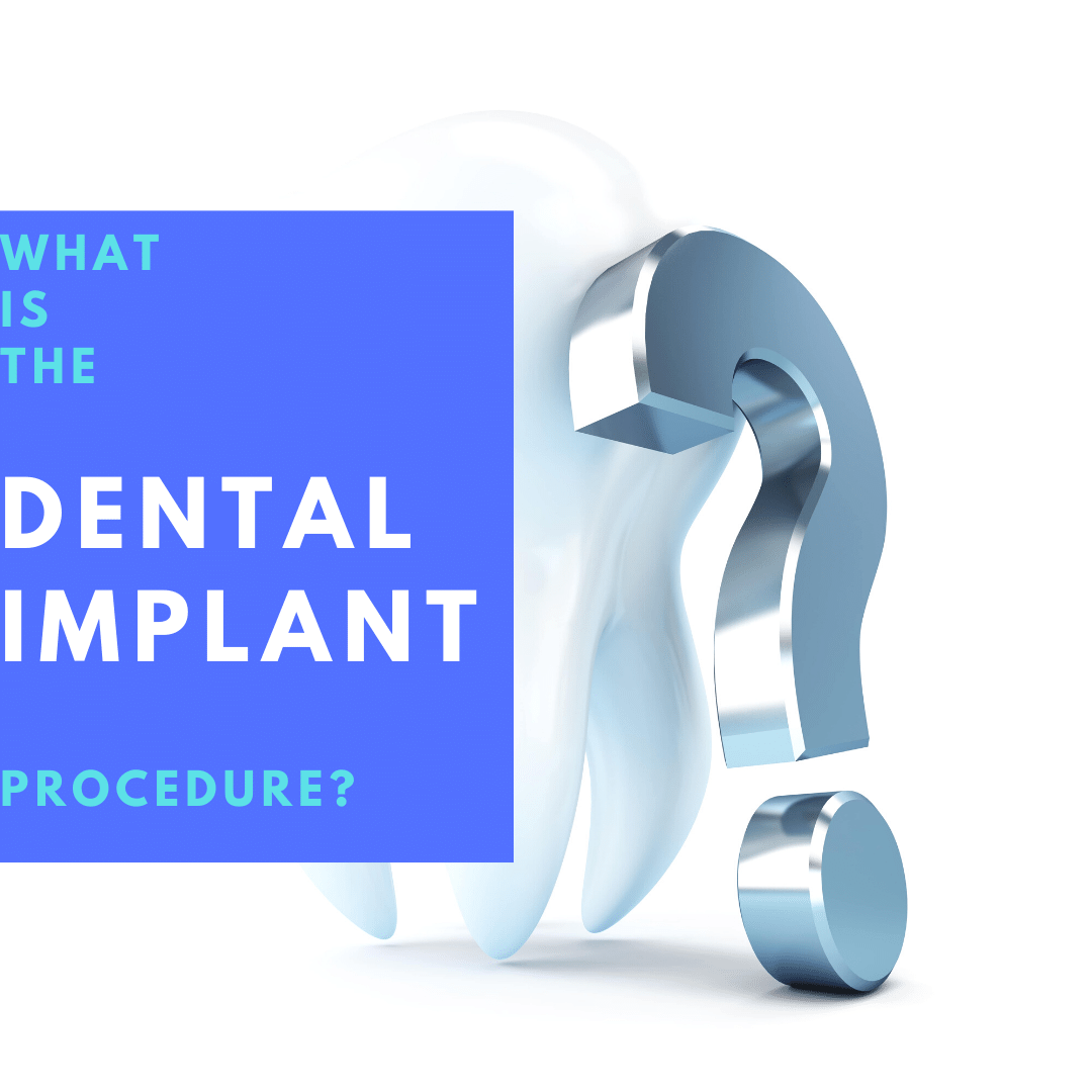 What is the Dental Implant Procedure