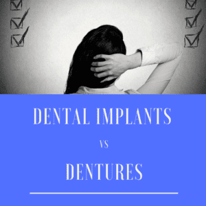 Dental Implants vs. Dentures