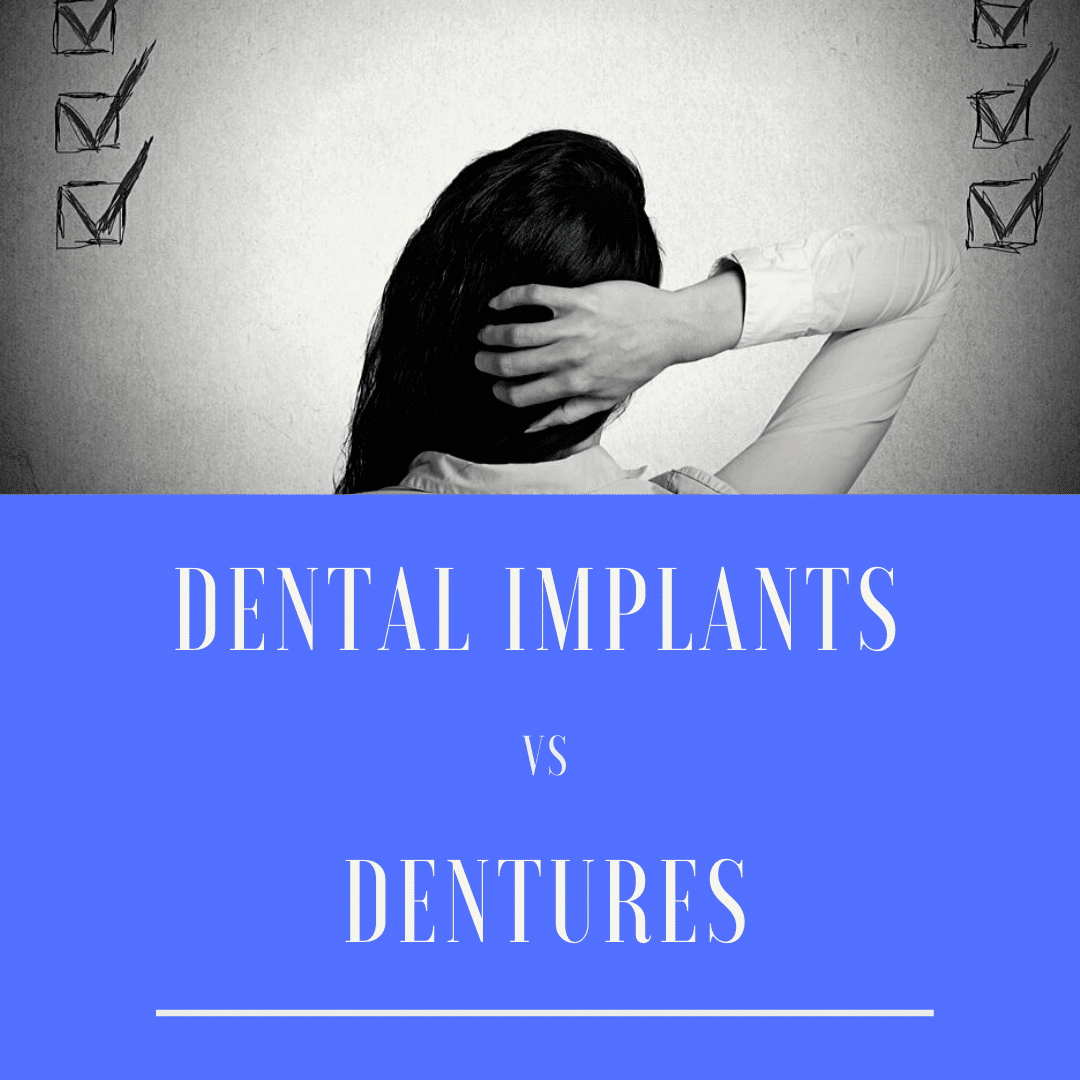 Dental Implants vs. Dentures
