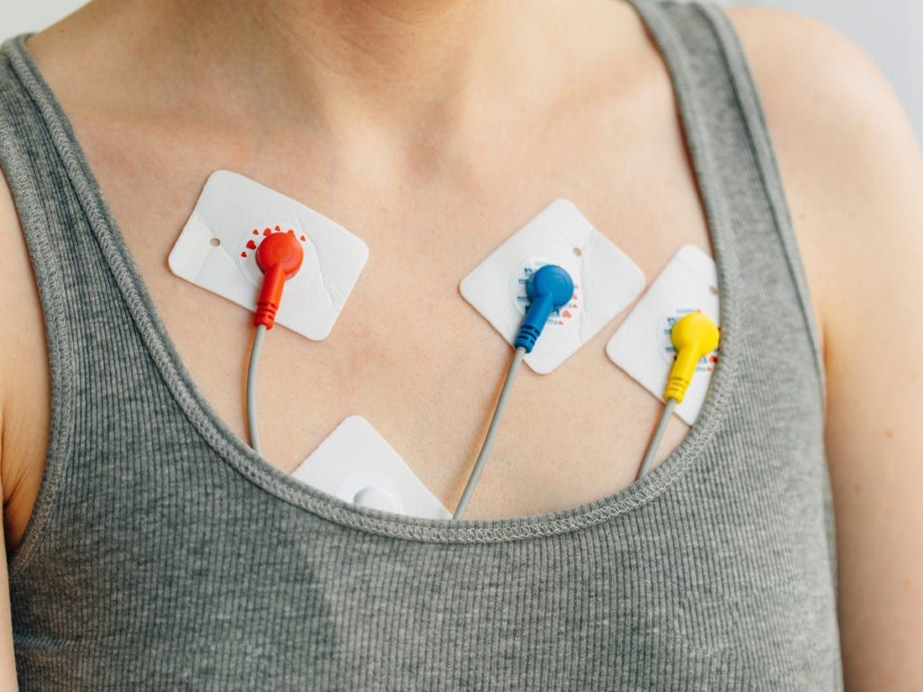 Patient's chest with EKG Pads attached