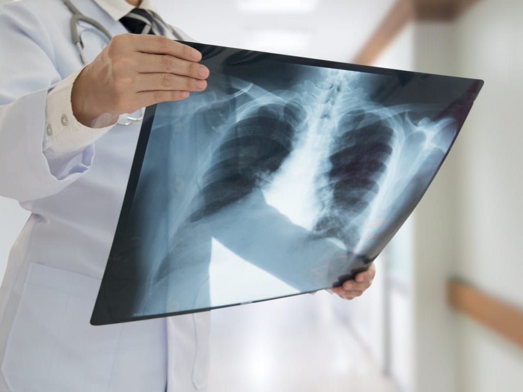 Physician holding an x-ray film