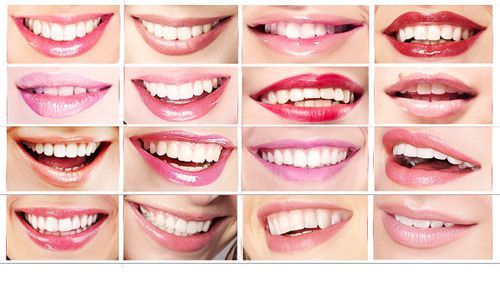 the-three-types-of-smiles-wellington-dentist-west-palm-beach