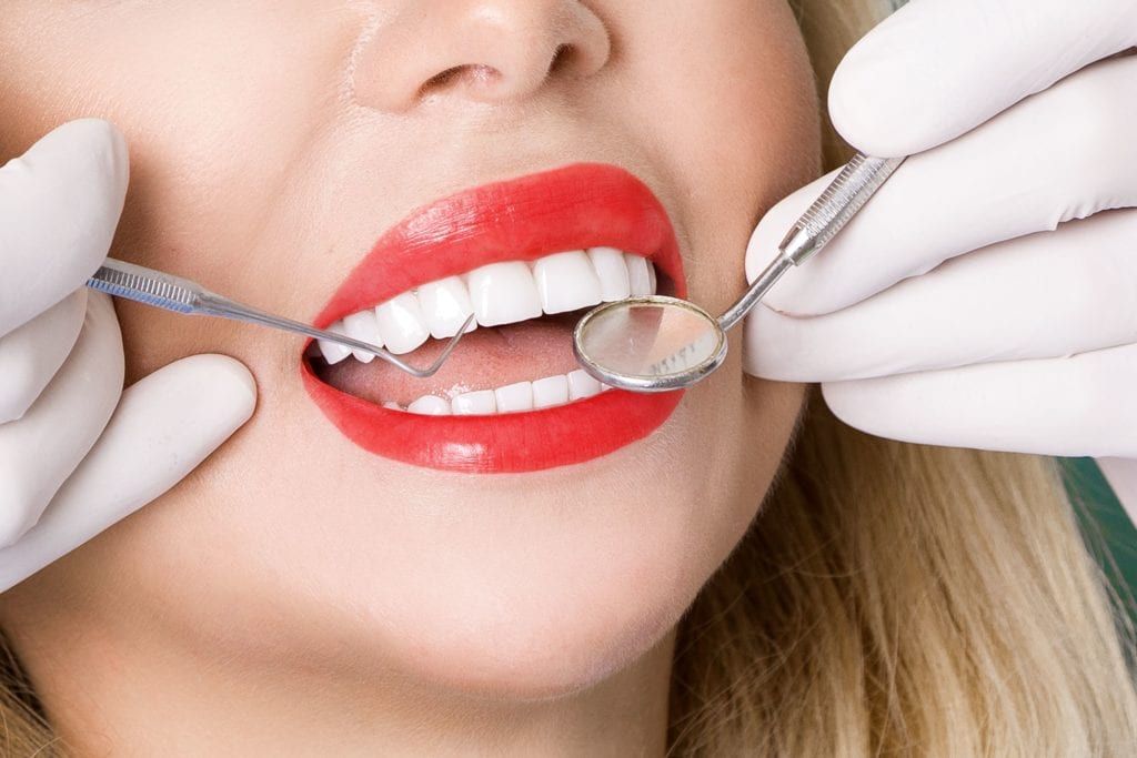 Woman being examined for veneers