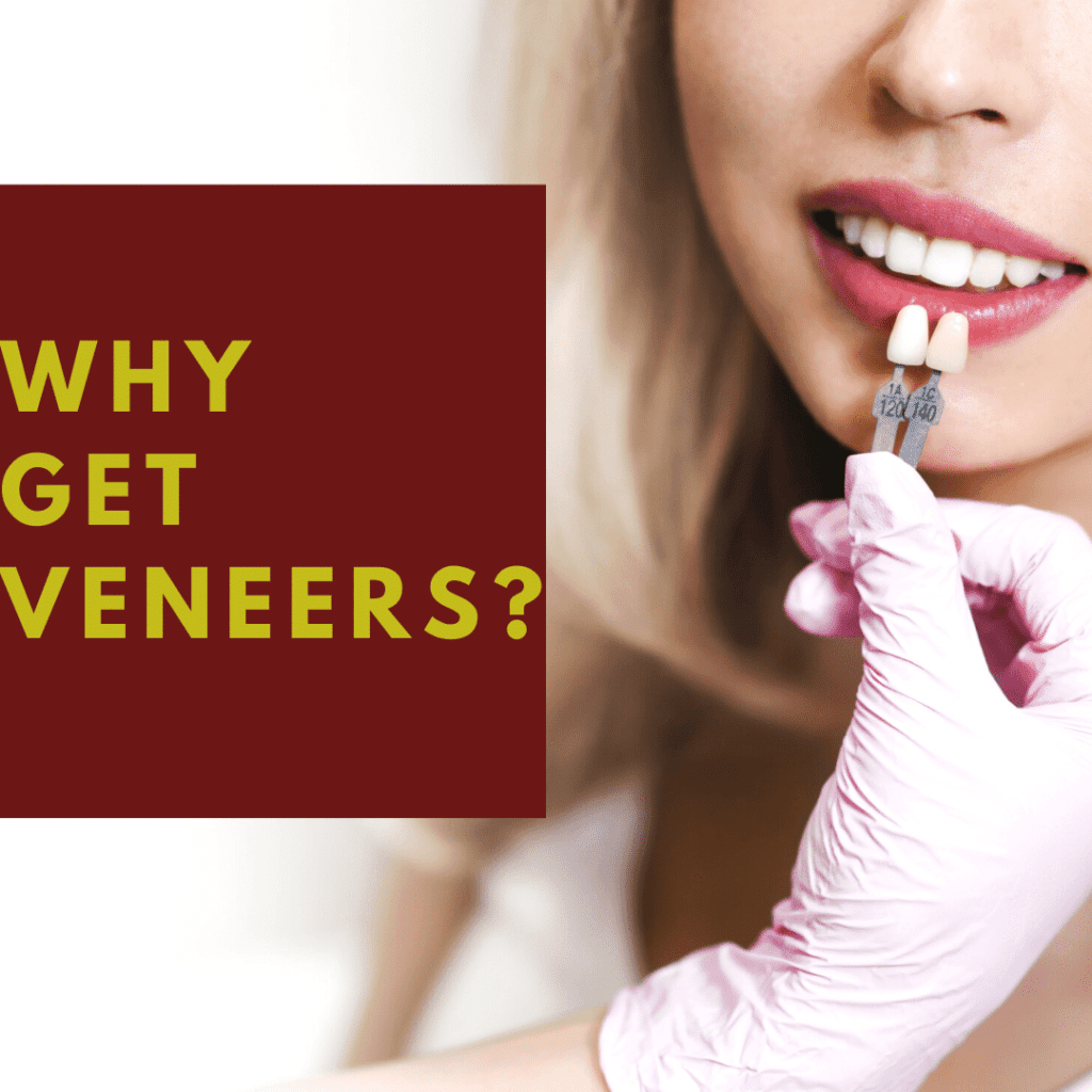Why Get Veneers? Wellington Dentist West Palm Beach Dentist