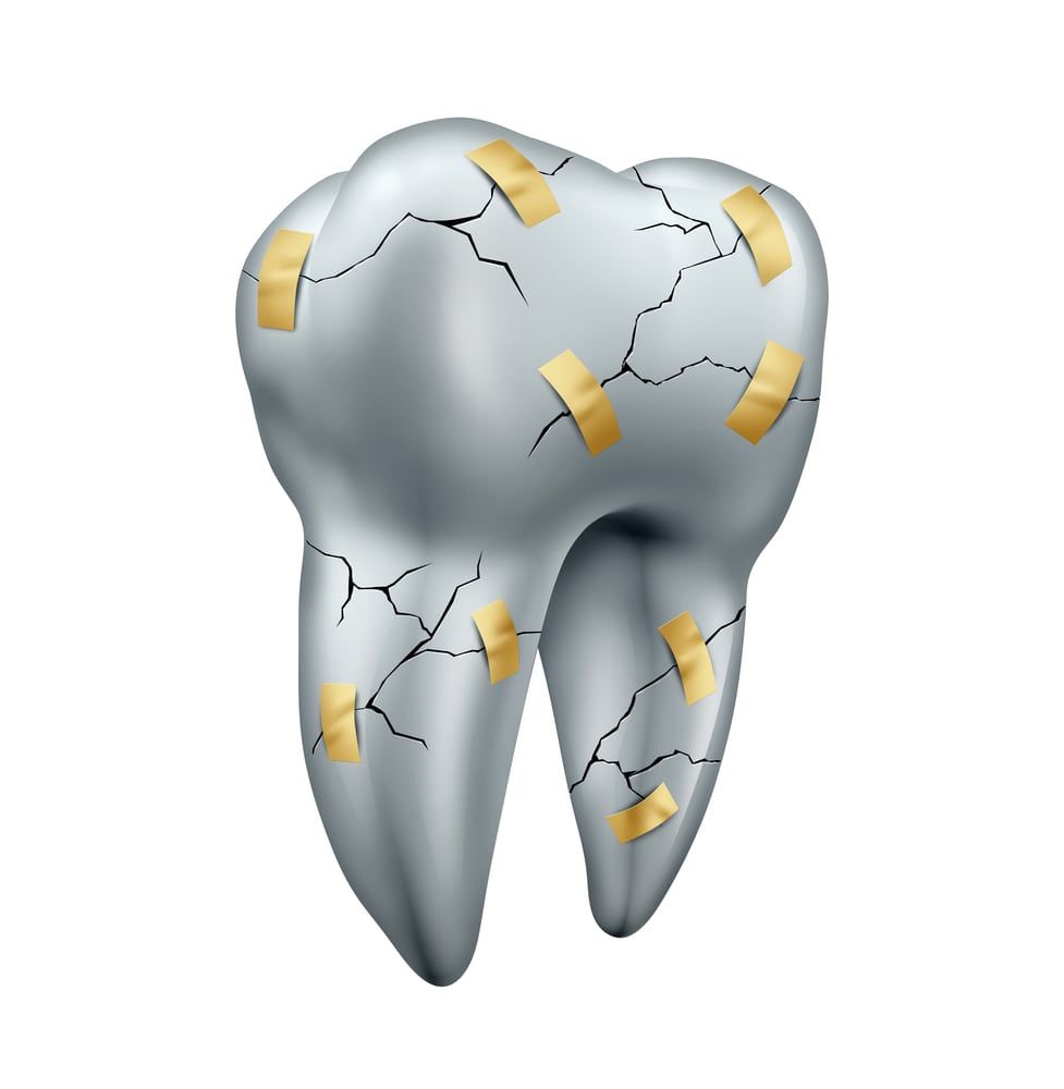 Tooth with several cracks and band-aids