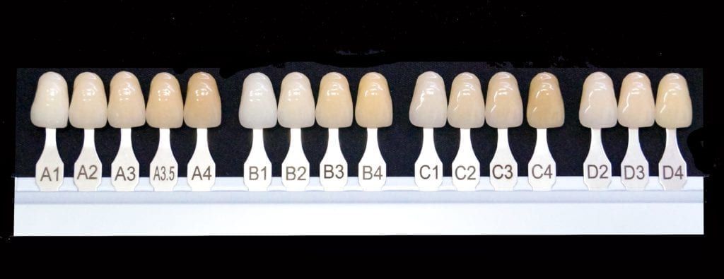 shade guide showing natural tooth color