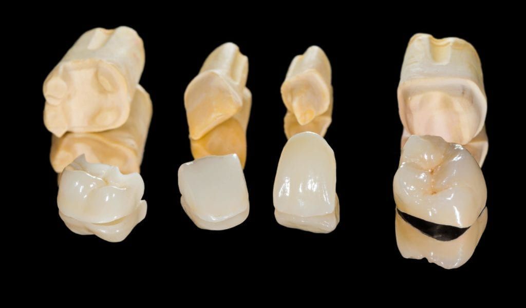 various dental restorations