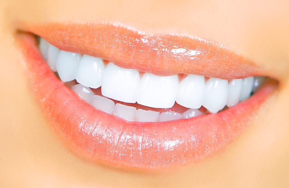 white teeth