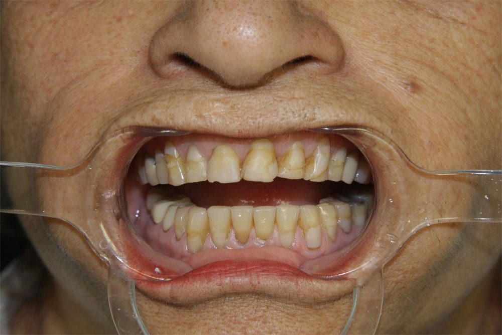 before and after photo (close shot)