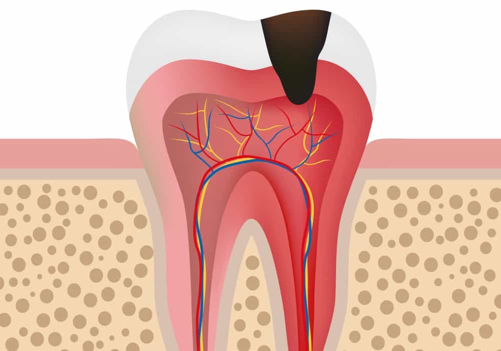 inner-tooth cartoon