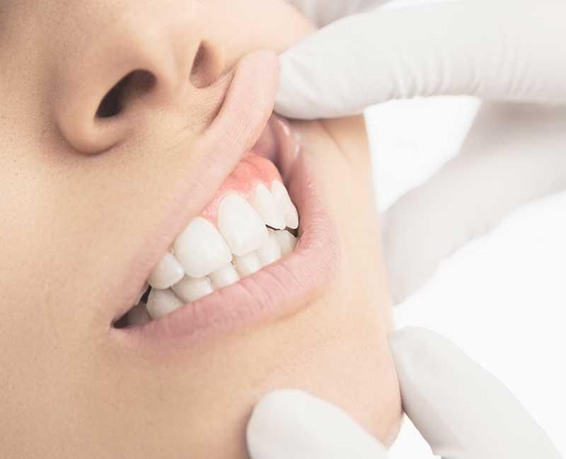 closeup image dentist touching patient mouth