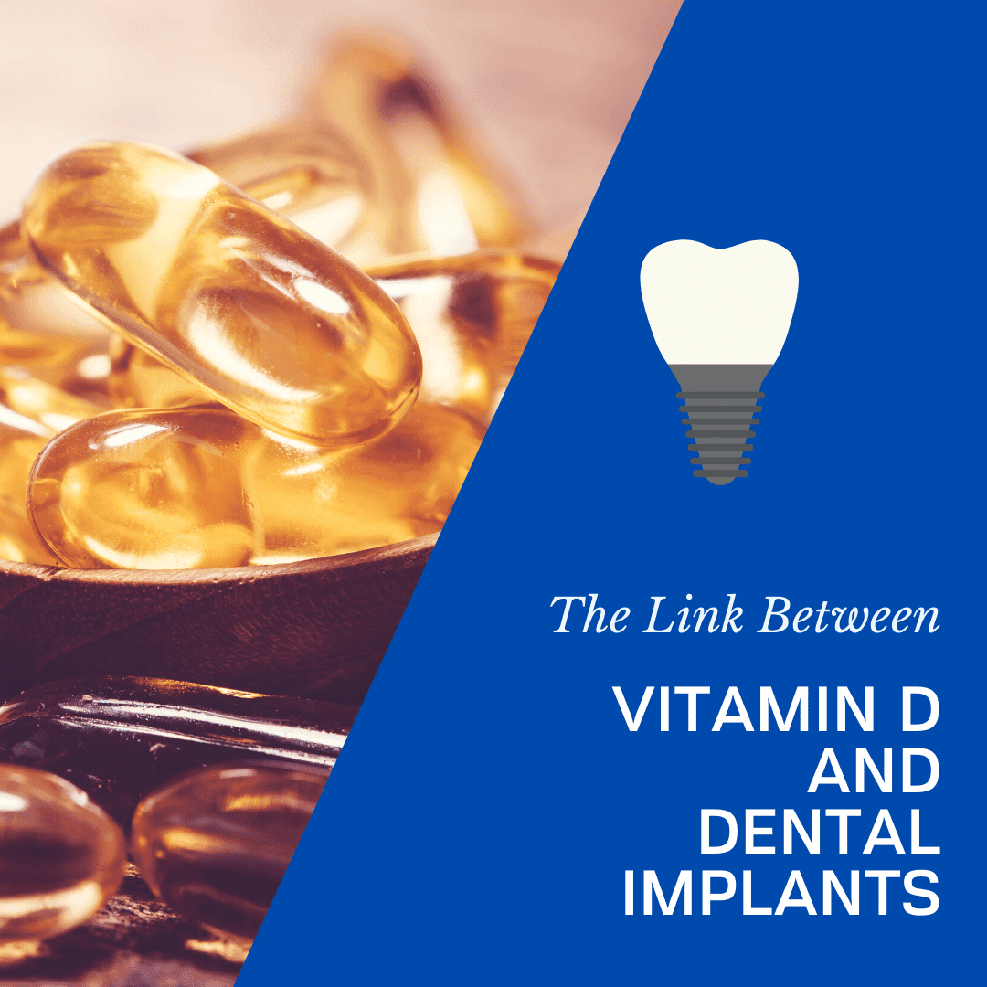 The Link Between Vitamin D and Dental Implants