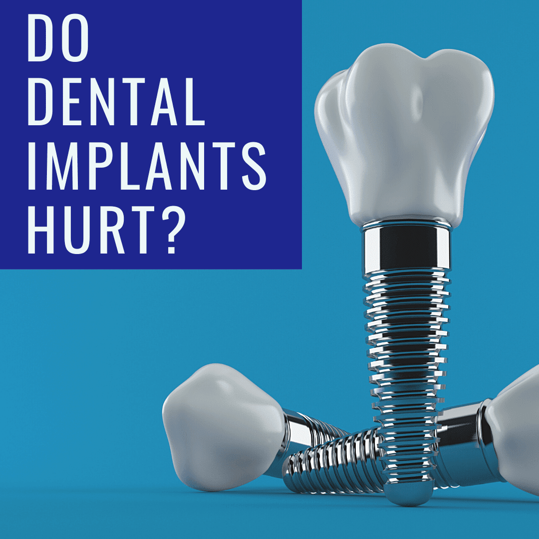 Do Dental implants hurt_